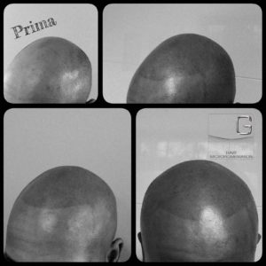 Tricopigmentation Originale Bordeaux