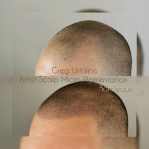 Greg Urfalino artist smp bordeaux #tricopigmentation #tricopigmentationbordeaux #smpbordeaux