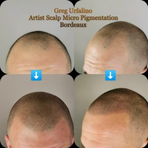 Greg Urfalino artist smp bordeaux #tricopigmentation #tricopigmentationbordeaux #smpbordeaux