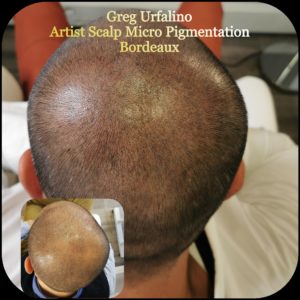 Greg Urfalino artist smp bordeaux #tricopigmentation #tricopigmentationbordeaux #smpbordeaux