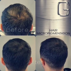 Tricopigmentation Bordeaux