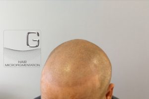 Tricopigmentation Bordeaux