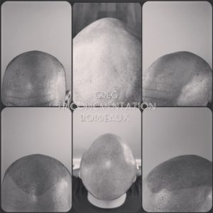 Tricopigmentation Bordeaux