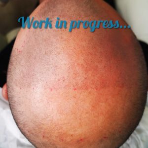 Tricopigmentation Bordeaux