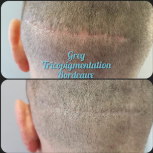 Greg Urfalino artist smp bordeaux #tricopigmentation #tricopigmentationbordeaux #smpbordeaux