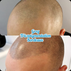 Greg Urfalino artist smp bordeaux #tricopigmentation #tricopigmentationbordeaux #smpbordeaux