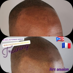 Greg Urfalino artist smp bordeaux #tricopigmentation #tricopigmentationbordeaux #smpbordeaux