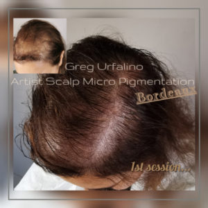 Greg Urfalino artist smp bordeaux #tricopigmentation #tricopigmentationbordeaux #smpbordeaux