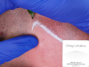 Greg Urfalino artist smp bordeaux #tricopigmentation #tricopigmentationbordeaux #smpbordeaux