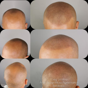 Greg Urfalino artist smp bordeaux #tricopigmentation #tricopigmentationbordeaux #smpbordeaux