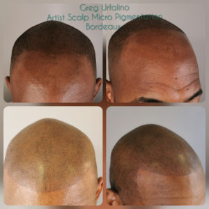 Greg Urfalino artist smp bordeaux #tricopigmentation #tricopigmentationbordeaux #smpbordeaux