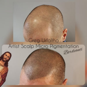 Greg Urfalino artist smp bordeaux #tricopigmentation #tricopigmentationbordeaux #smpbordeaux