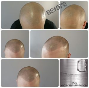 Tricopigmentation Originale Bordeaux